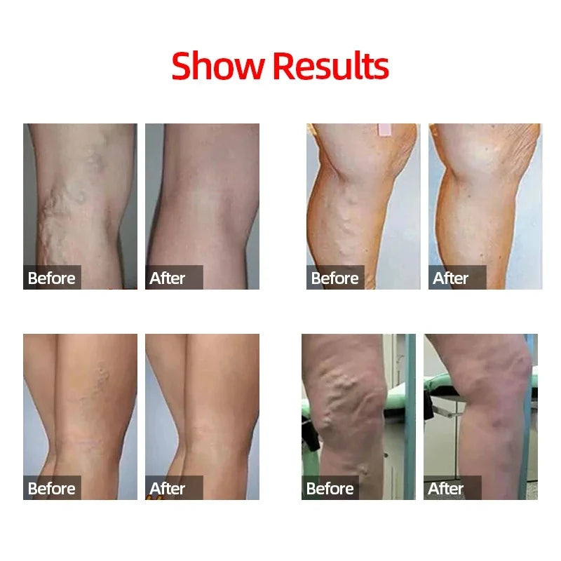 Compression Calf Sleeves for Running & Training